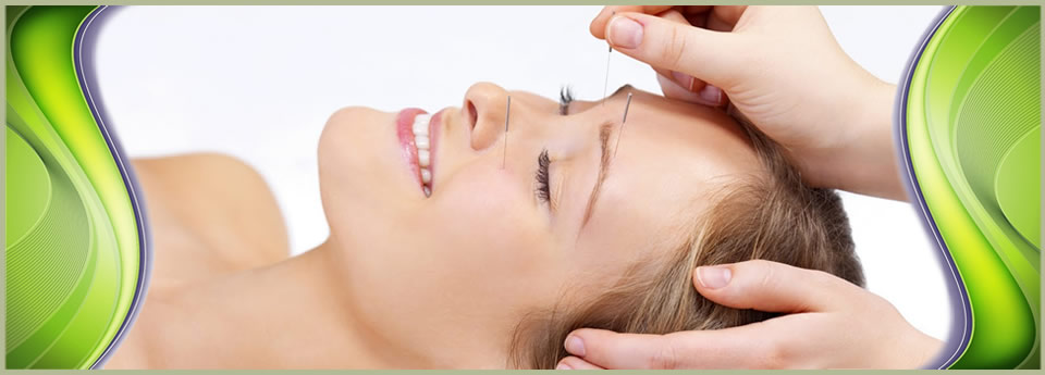 How Acupuncture Provides Natural Relief for Toronto’s Spring Allergy Season
