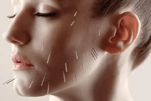 Cosmetic Acupuncture vs. Botox: An Honest Comparison