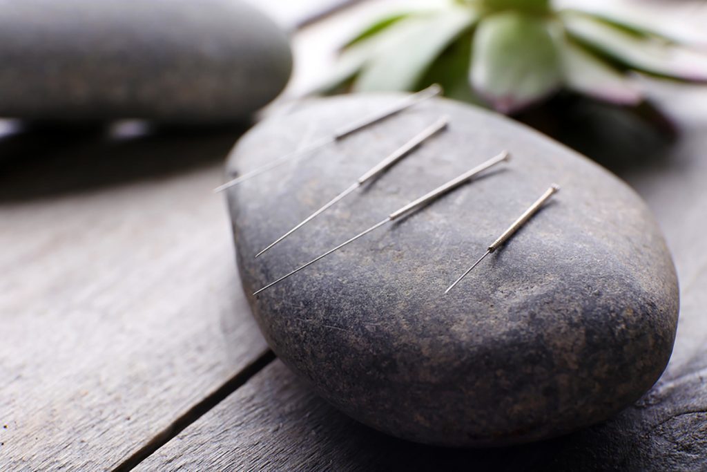 Acupuncture for Anxiety Toronto: What the Research Shows and What to Expect