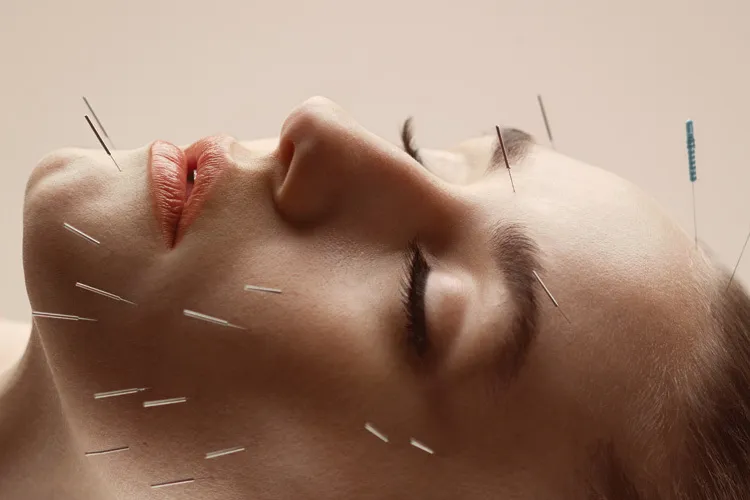 Toronto’s Natural Facelift: Cosmetic Acupuncture + Sculptural Face Lifting™ Explained