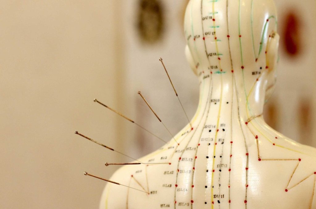 How Many Acupuncture Sessions Do I Need? A Toronto Acupuncturist Explains